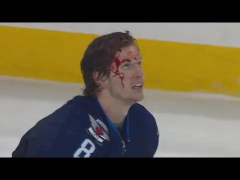 Jacob Trouba