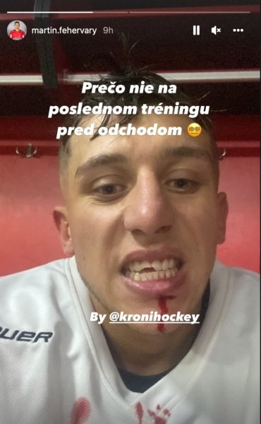 FOTO Fehérváry na poslednom tréningu pred odletom do zámoria utrpel krvavé a veľmi nepríjemné zranenie